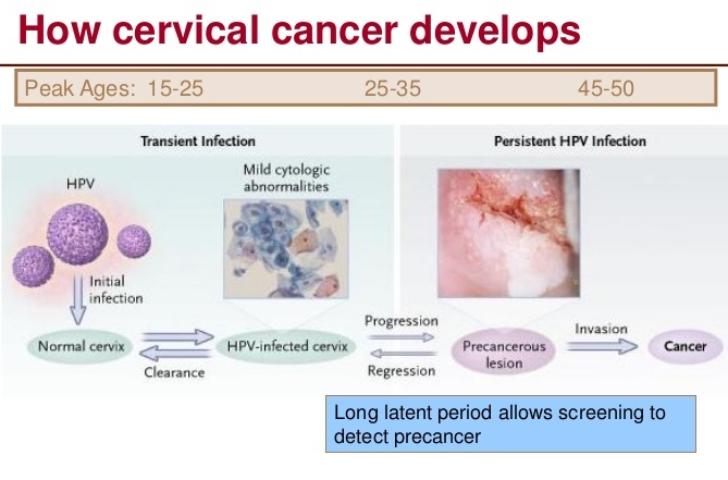 How cervical cancer develops
