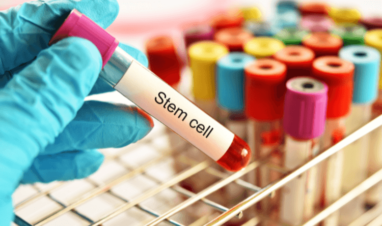 Stem Cell