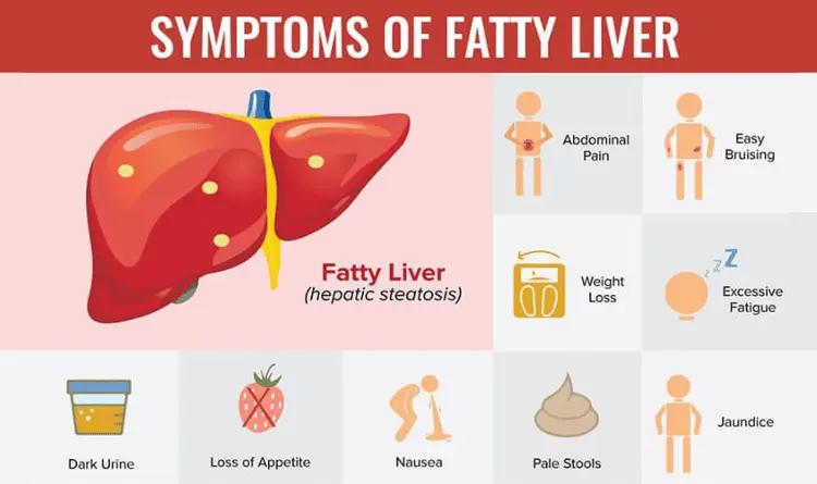 symptoms of fatty liver
