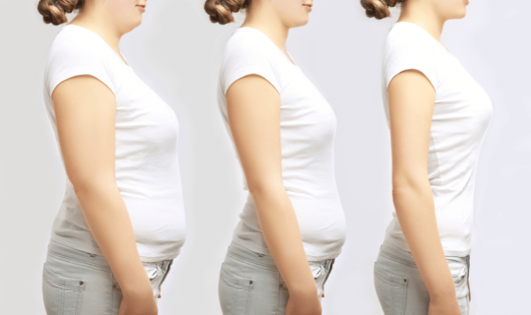 weight loss without bariatric surgery