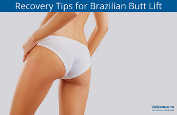 What are the Top Recovery Tips for Brazilian Butt Lift?