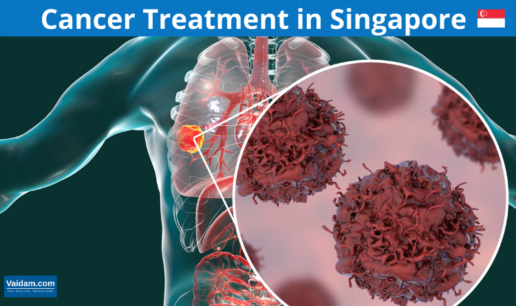 Cancer treatment in Singapore
