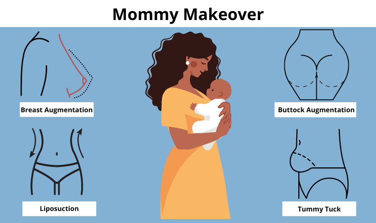 Mommy makeover