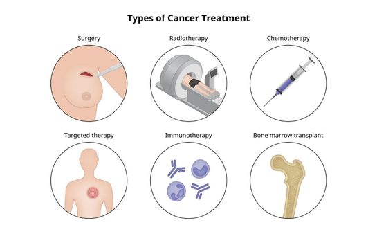 Types of cancer treatment