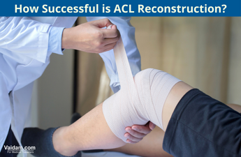 How successful is ACL reconstruction?