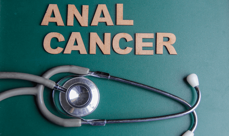 anal-cancer