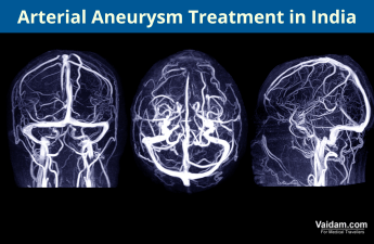 Arterial Aneurysm
