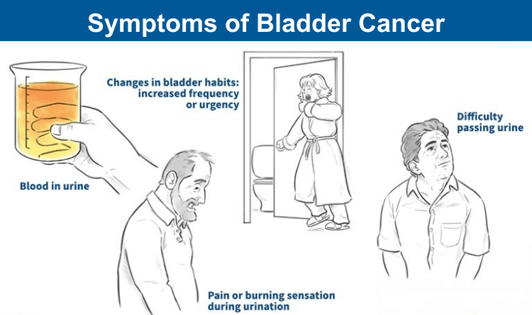 bladder cancer symptoms