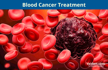 Tratamento do câncer de sangue