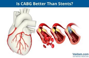 Is CABG Better than Stents