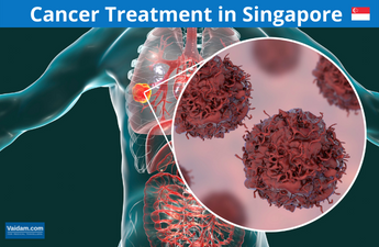 Cancer Treatment in Singapore 
