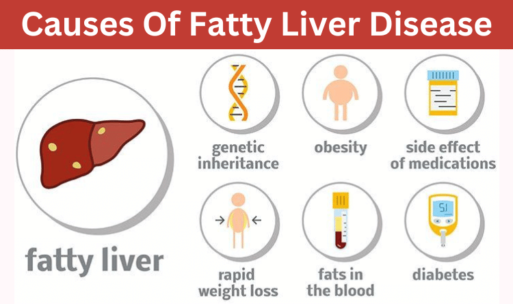 causes of fatty liver