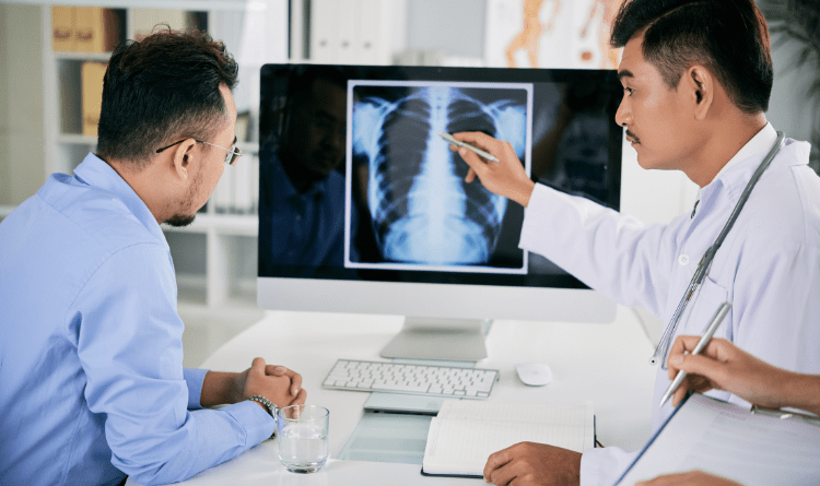 radiographie pulmonaire