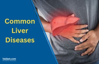 Common Liver Diseases: Causes, Symptoms, and Prevention
