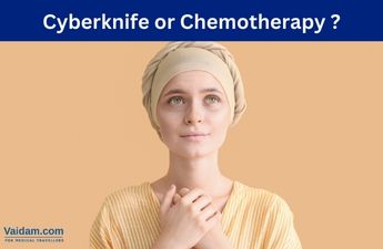Cyberknife أو العلاج الكيميائي