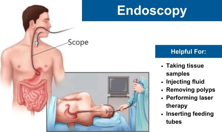endoscopy