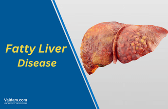 Fatty Liver Disease: Understanding Its Types and Treatment