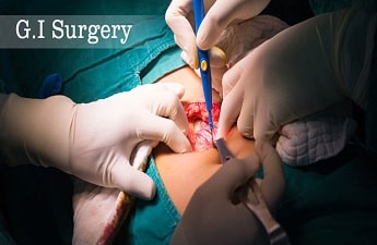 Chirurgie GI
