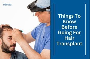 7 Things to Know Before Going for Hair Transplant