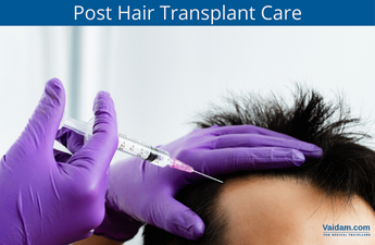 Como cuidar do seu cabelo após o transplante capilar?