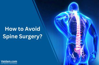 How To Avoid Spine Surgery