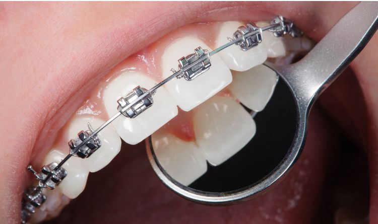 how long dental procedure take