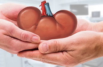kidney tranplant cost in India