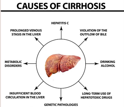 Causes of Cirrhosis