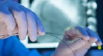 Aurangabad Doctors Performed Angioplasty through the Hand