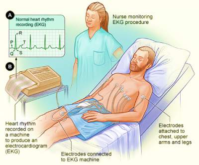 Electro Cardio Gram (ECG)