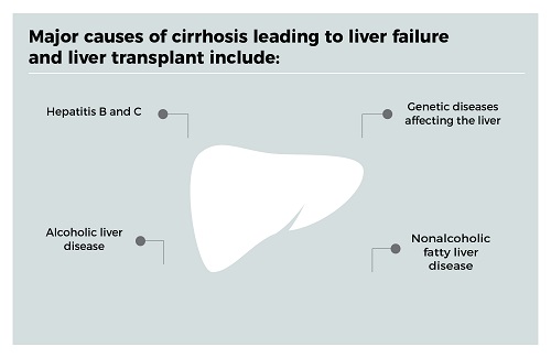 liver transplant reasons