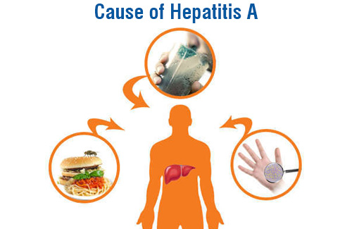 causes of hepatitis A