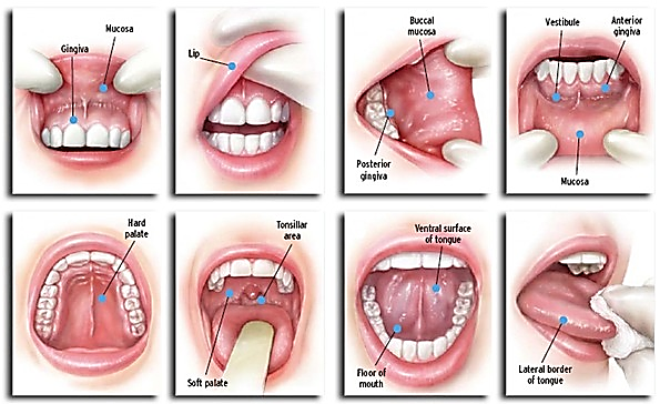 Oral Cancer Screening Steps