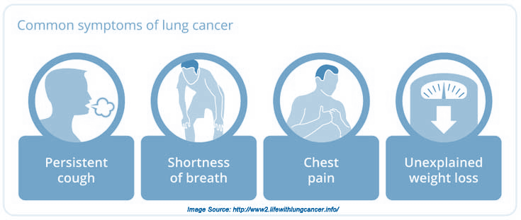 Signs and Symptoms of Lung Cancer