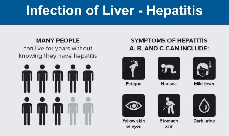 hepatitis liver disease