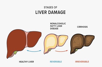 Suffering from Liver Disease Contact One of the Best Gastroenterologist, Dr. Randhir Sud, For All Your Queries