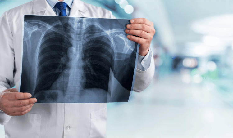 Переваги лікування онкології легень в Німеччині