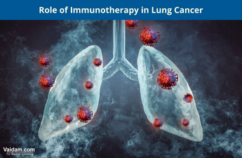 Role of immunotherapy in lung cancer