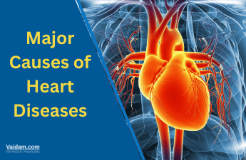 Major Causes of Heart Diseases