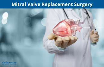 Mitral Valve Replacement