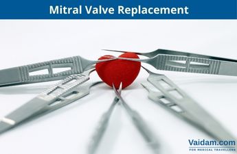 How Many Times Can You Replace A Mitral Valve?