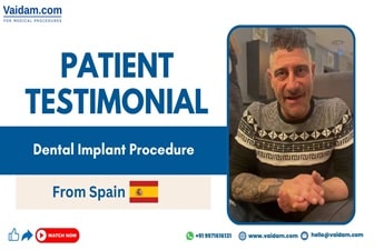 Dental Implant Surgery - Spain