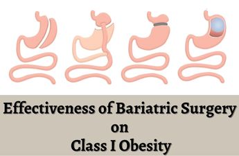  Bariatric Surgery helps Class 1 obesity patients