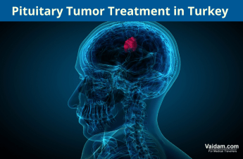 Pituitary Tumor Treatment in Turkey