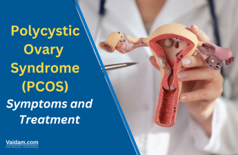Understanding Polycystic Ovary Syndrome: Symptoms and Treatment Options