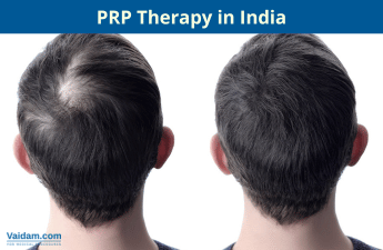 Terapia PRP na Índia
