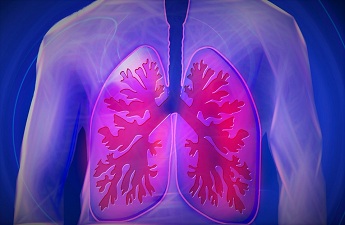 pulmoner fibroz