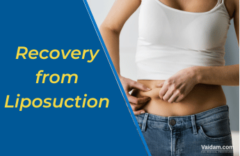 Recover From Liposuction