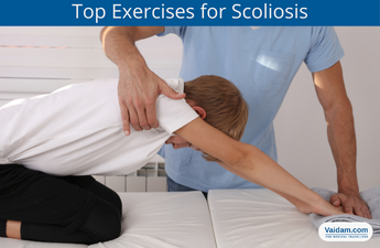 What Are The Top Exercises For Scoliosis?