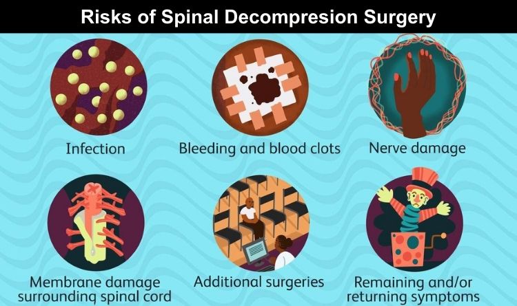 spinal decompression risks